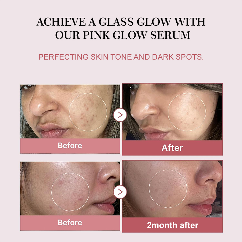 Salmon PDRN Collagen Peptide F - Beauty Makeup Korean ulasan dan harga